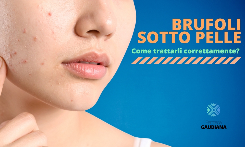 Come eliminare i brufoli sottopelle: la guida completa