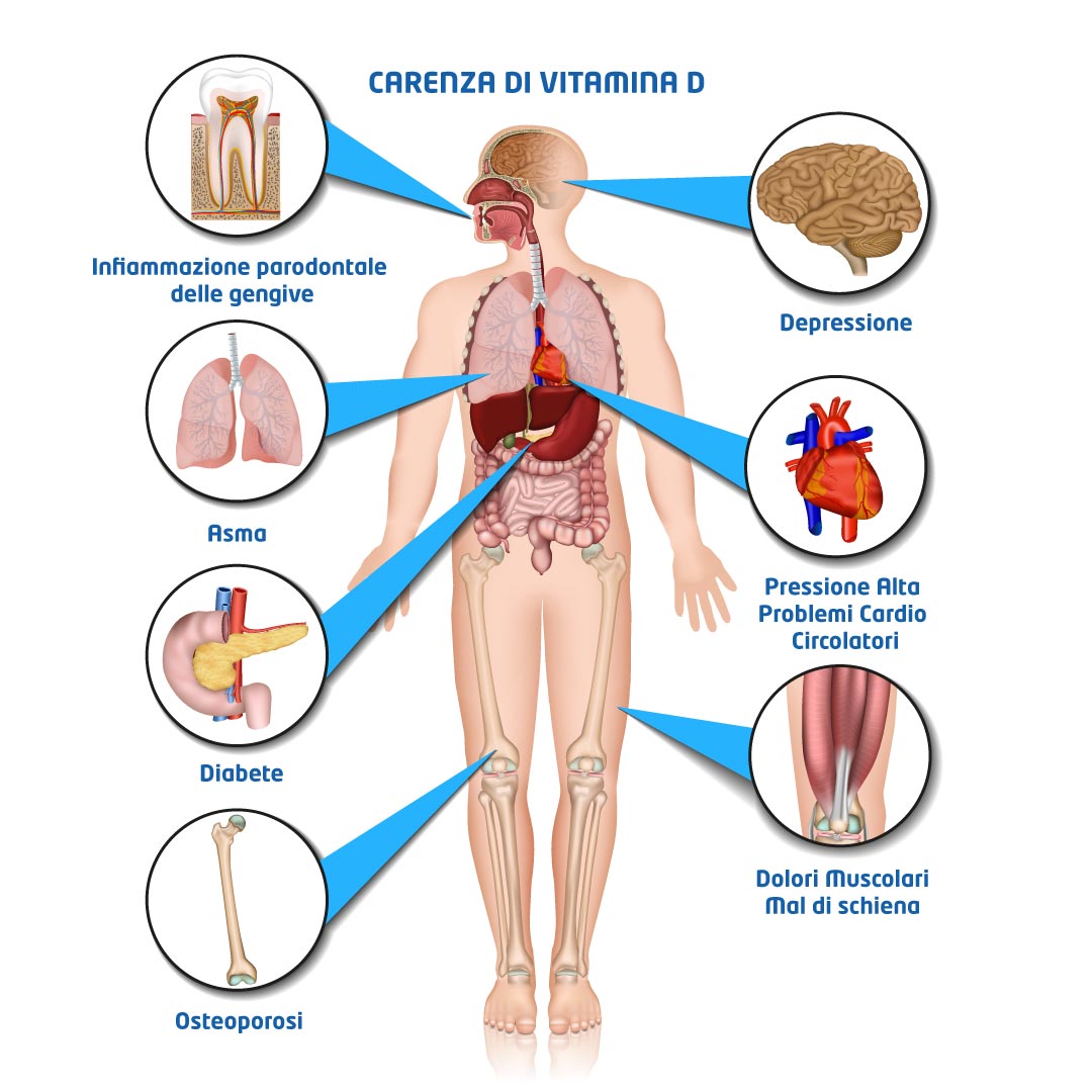 Vitamina D Bassa 8 Segni E Sintomi Della Sua Carenza Farmaciagaudiana It