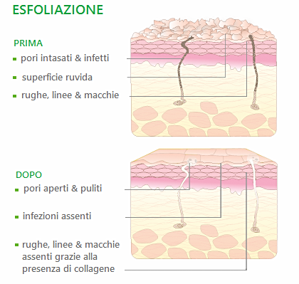 come esfoliare pelle