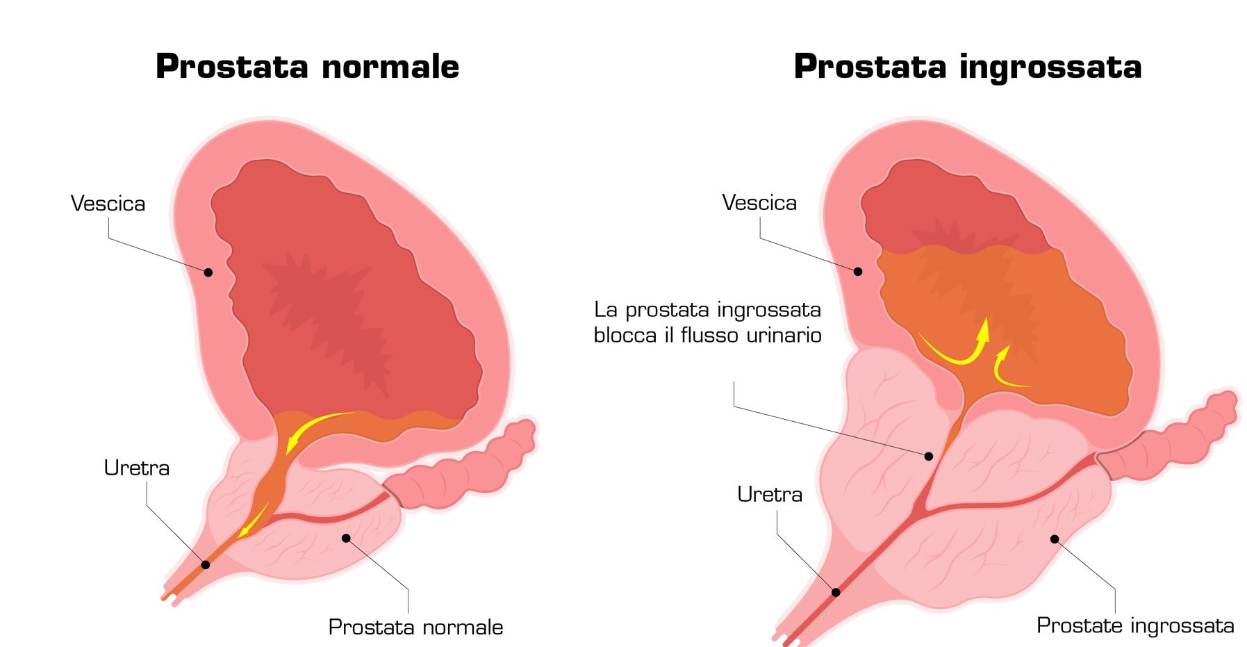 integratori per ipertrofia prostata